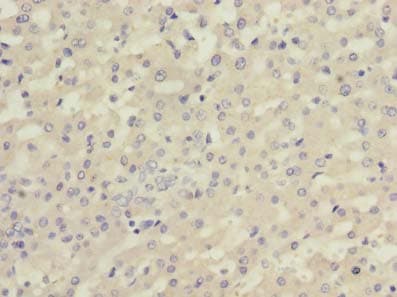 IHC-plus™ Polyclonal Rabbit anti-Human Complement C5 Antibody (IHC)