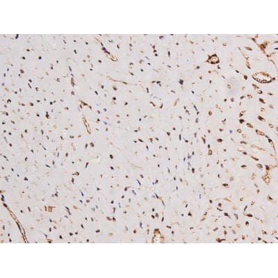 Polyclonal Rabbit anti-Human MAPT / Tau Antibody (phospho-Ser235, IHC, WB)