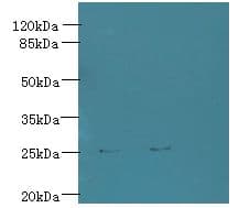 TREM2 / TREM-2 Antibody