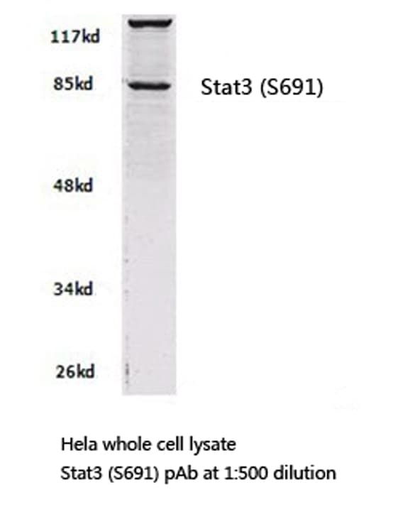 Polyclonal Rabbit anti-Human STAT3 Antibody (Ser691, IHC, WB)