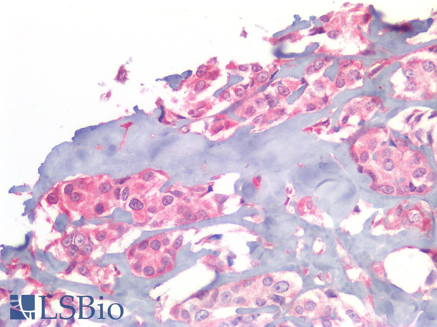 PathPlus™ Polyclonal Rabbit anti-Human EGFR Antibody (C-Terminus, IHC)