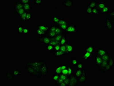 Polyclonal Rabbit anti-Human HIST1H1C Antibody (IHC)