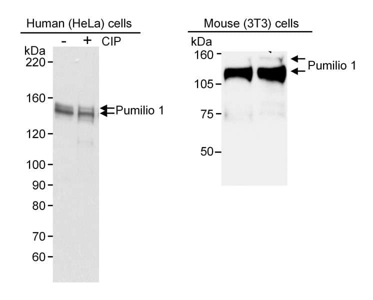 PUM1 Antibody (aa225-275)