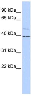 KCNK9 / TASK3 Antibody (aa36-85)