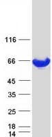 Human PKM / Pyruvate Kinase, Muscle Protein (Recombinant Myc-DDK (Flag))