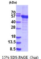 Human RNMTL1 Protein (Recombinant His)