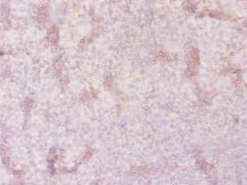 Polyclonal Rabbit anti-Human SLC41A2 Antibody (IHC, WB)