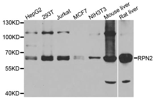 Polyclonal Rabbit anti-Human RPN2 / Ribophorin II Antibody (IHC, WB)