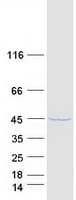 Human GMPR2 Protein (Recombinant Myc-DDK (Flag))