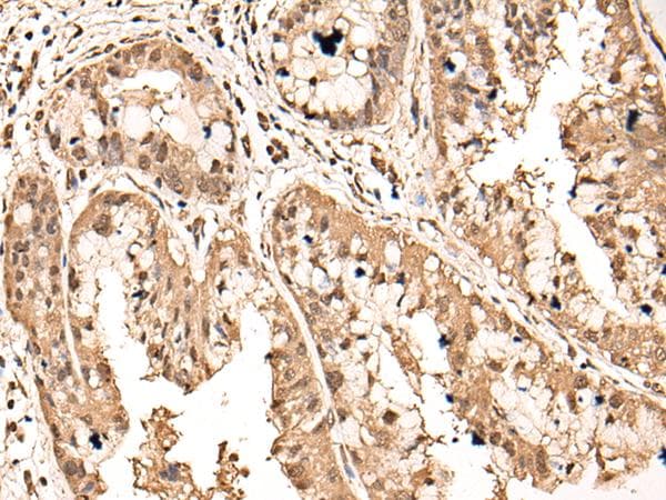 ATAD3A Antibody