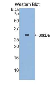 FKBP10 / FKBP65 Antibody (aa316-573, Biotin)