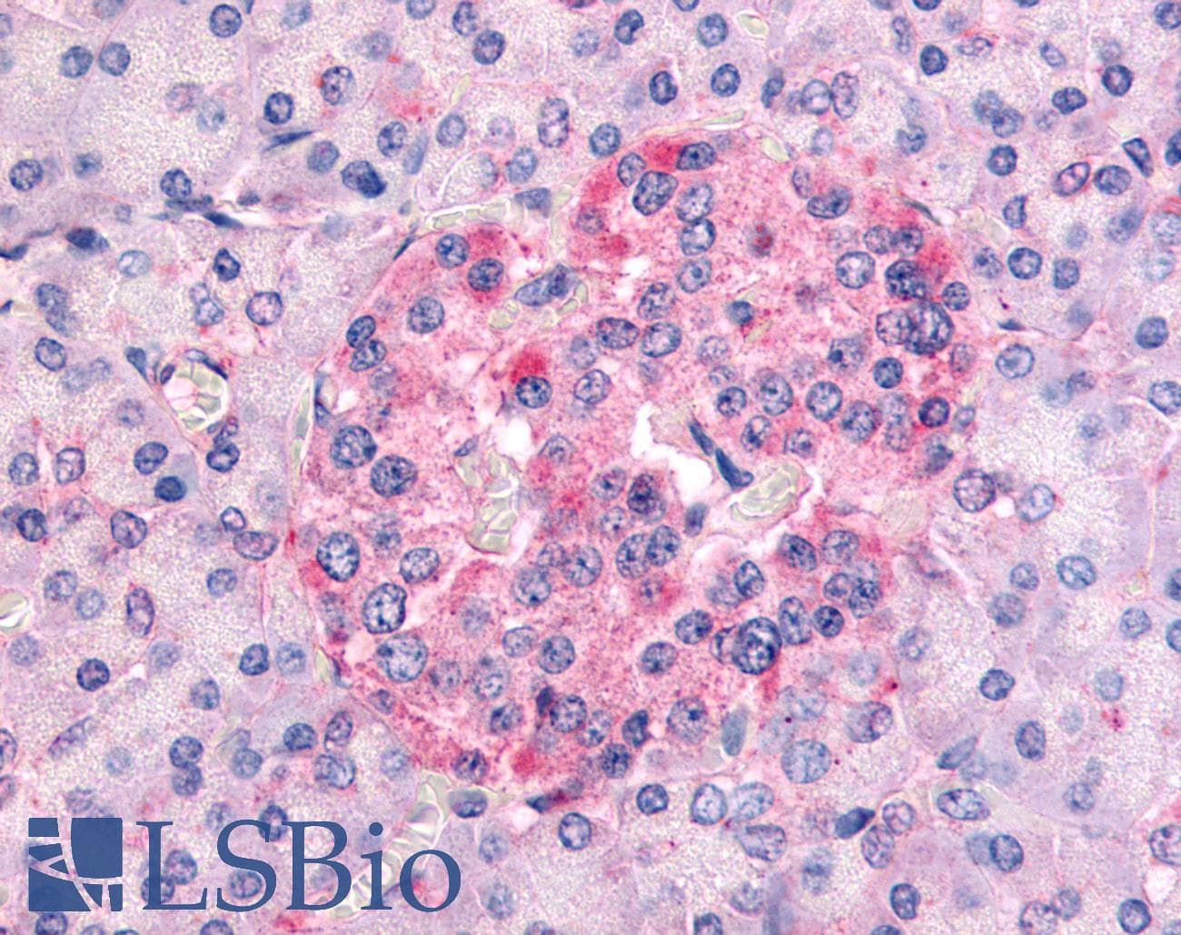 IHC-plus™ SGK1 / SGK Antibody (aa400-431)