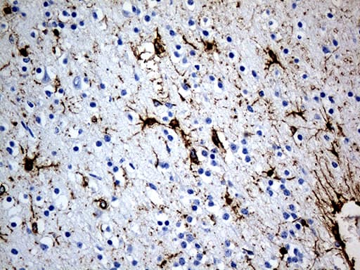 Monoclonal Mouse anti-Human GFAP Antibody (clone UMAB5, IHC, IF, WB)