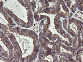 UBE2J1 Antibody (clone OTI1C7)