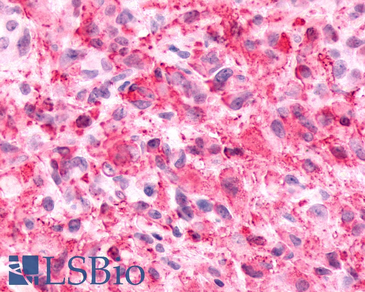 PathPlus™ ADRA2C Antibody (Extracellular Domain)
