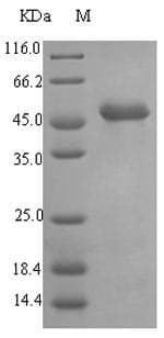 Pseudomonas aeruginosa lasB Protein (Recombinant 6His-SUMO, N-terminus)