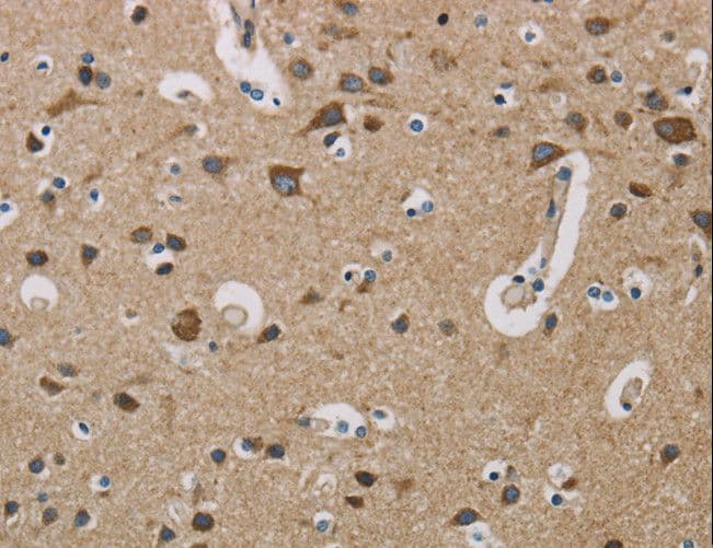 Polyclonal Rabbit anti-Human COXG / COX6B1 Antibody (IHC, WB)