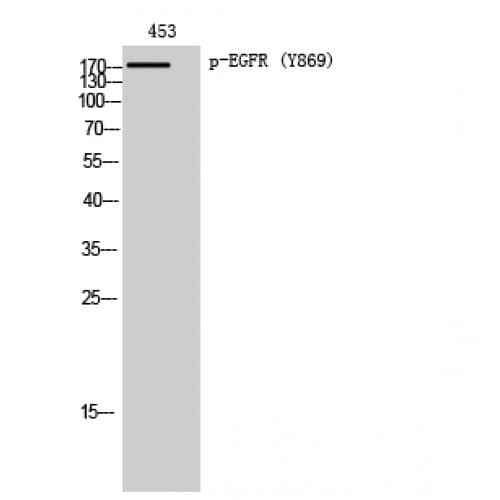Polyclonal Rabbit anti-Human EGFR Antibody (810-890 aa, IF, WB)