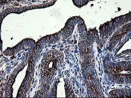 MAC-2-BP / LGALS3BP Antibody (clone OTI3G8)