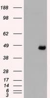 Monoclonal Mouse anti-Human MAP2K4 / MKK4 Antibody (clone OTI8A8, IHC, IF, WB)