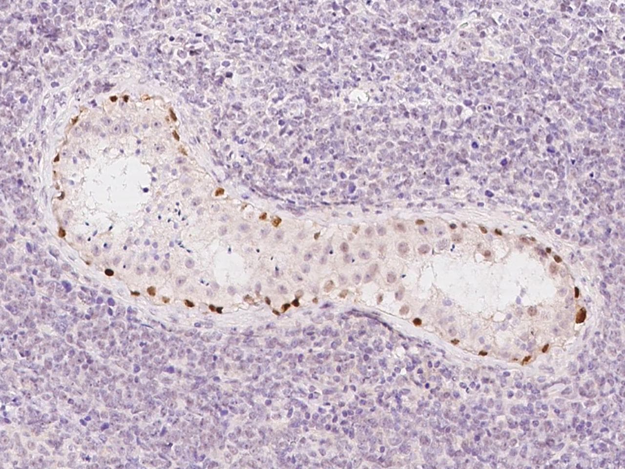 MORC1 Antibody