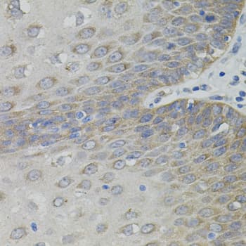 Polyclonal Rabbit anti-Human SLC30A1 / ZNT1 Antibody (IHC, WB)