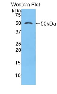 CTSK / Cathepsin K Antibody (aa113-316)