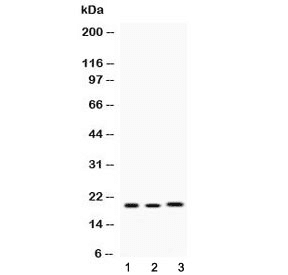 Polyclonal Rabbit anti-Human AGR2 Antibody (IHC, WB)