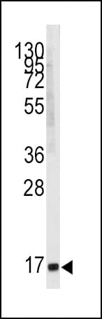 IHC-plus™ MGST1 Antibody (aa40-71)