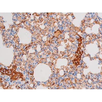 Polyclonal Rabbit anti-Human DNM1 / Dynamin Antibody (phospho-Ser774, IHC, WB)