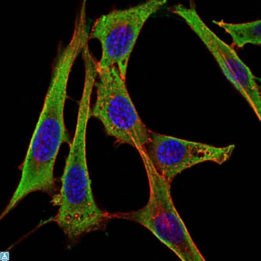 FGG / Fibrinogen Gamma Antibody