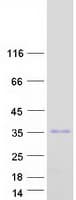 Human ZFAND5 Protein (Recombinant Myc-DDK (Flag))