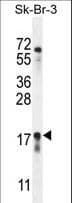 C1orf115 Antibody (aa76-104)