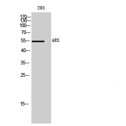 Polyclonal Rabbit anti-Human ARX Antibody (250-330 aa, Internal, WB)
