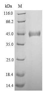 Zaire Ebolavirus Nucleocapsid Protein (Recombinant 6His, N-terminus)