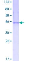 Human NME3 Protein (Recombinant GST)