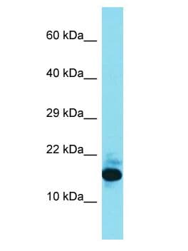 Polyclonal Rabbit anti-Human FAM177B Antibody (aa108-157, WB)