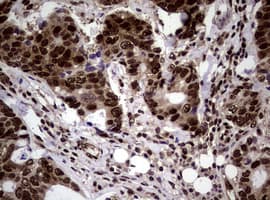 Monoclonal Mouse anti-Human NBN / Nibrin Antibody (clone OTI8E7, IHC, WB)