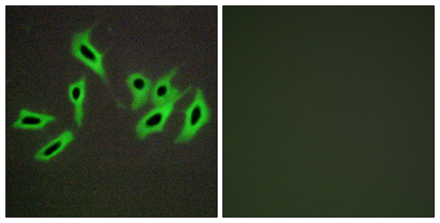 SERPIND1 / Heparin Cofactor 2 Antibody