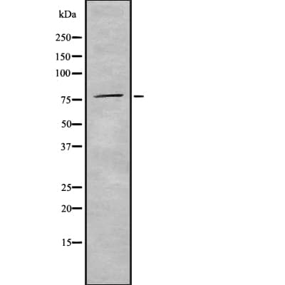 GTSE1 Antibody