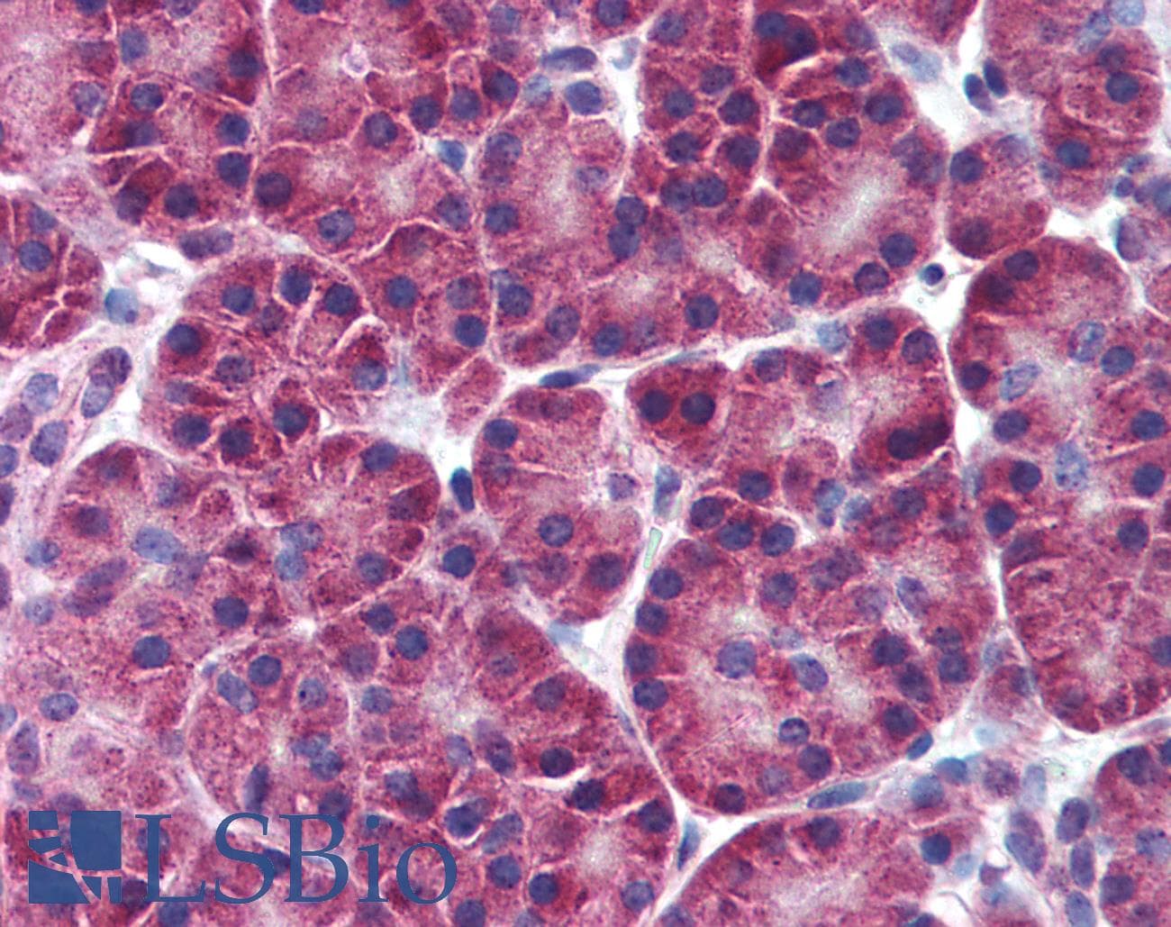IHC-plus™ ALOX5 / 5-LOX Antibody (aa100-200)