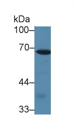 CALD1 / Caldesmon Antibody