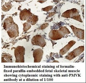 PMVK Antibody (aa14-191)