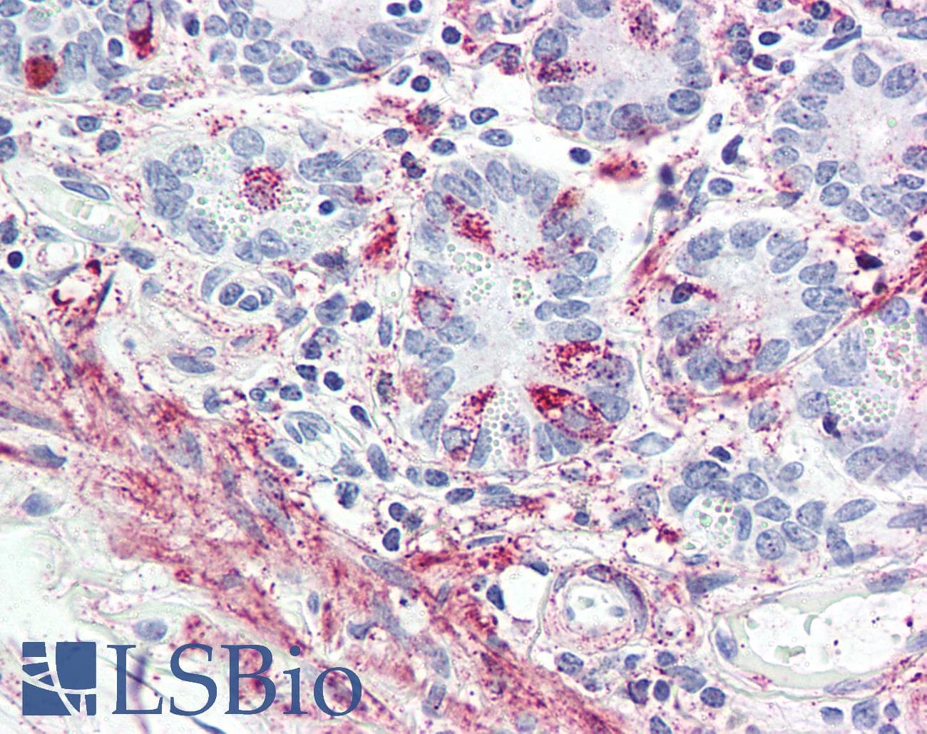 IHC-plus™ Polyclonal Rabbit anti-Human GLP2R Antibody (Internal, IHC)