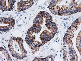 AK4 / Adenylate Kinase 4 Antibody (clone OTI3B1, Carrier-free)