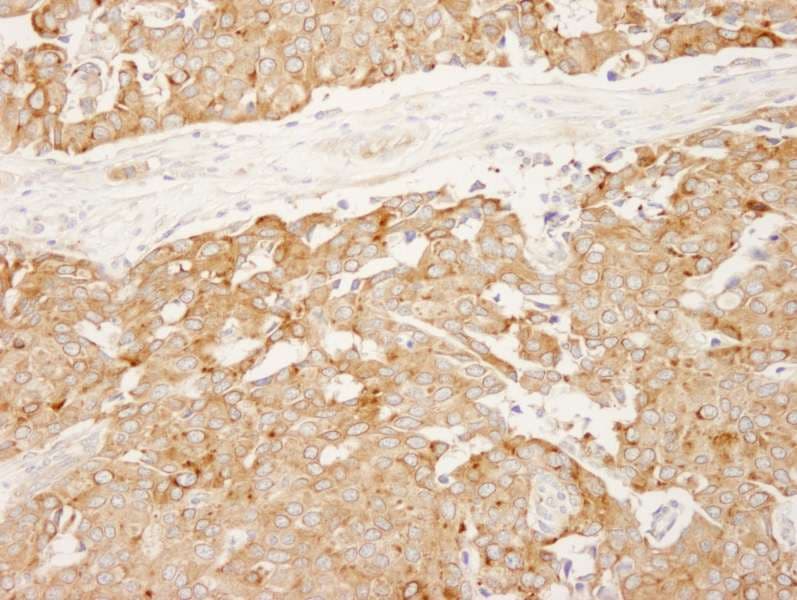 RCN1 / Reticulocalbin 1 Antibody (aa1-75)