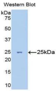 TNNI3 / Cardiac Troponin I Antibody (aa1-203)