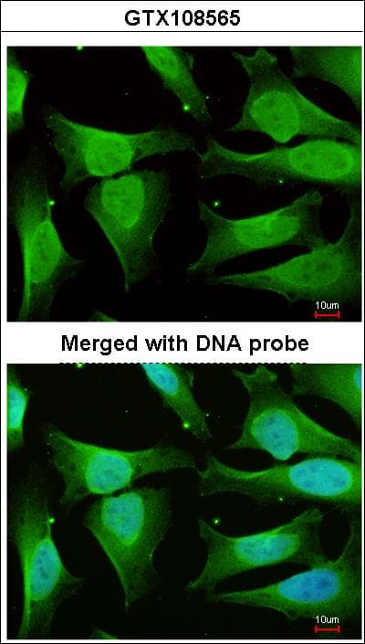 CAMK1D Antibody (aa1-385)