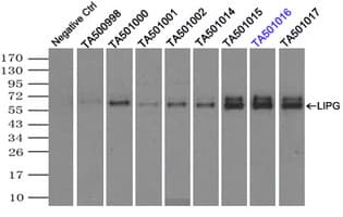 LIPG / Endothelial Lipase Antibody (clone OTI1D9, Carrier-free)