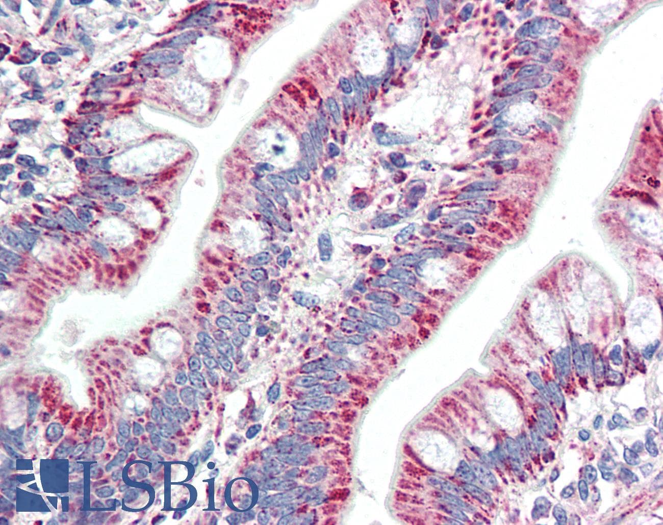 IHC-plus™ Polyclonal Goat anti-Human ZNF652 Antibody (aa594-606, IHC, WB)